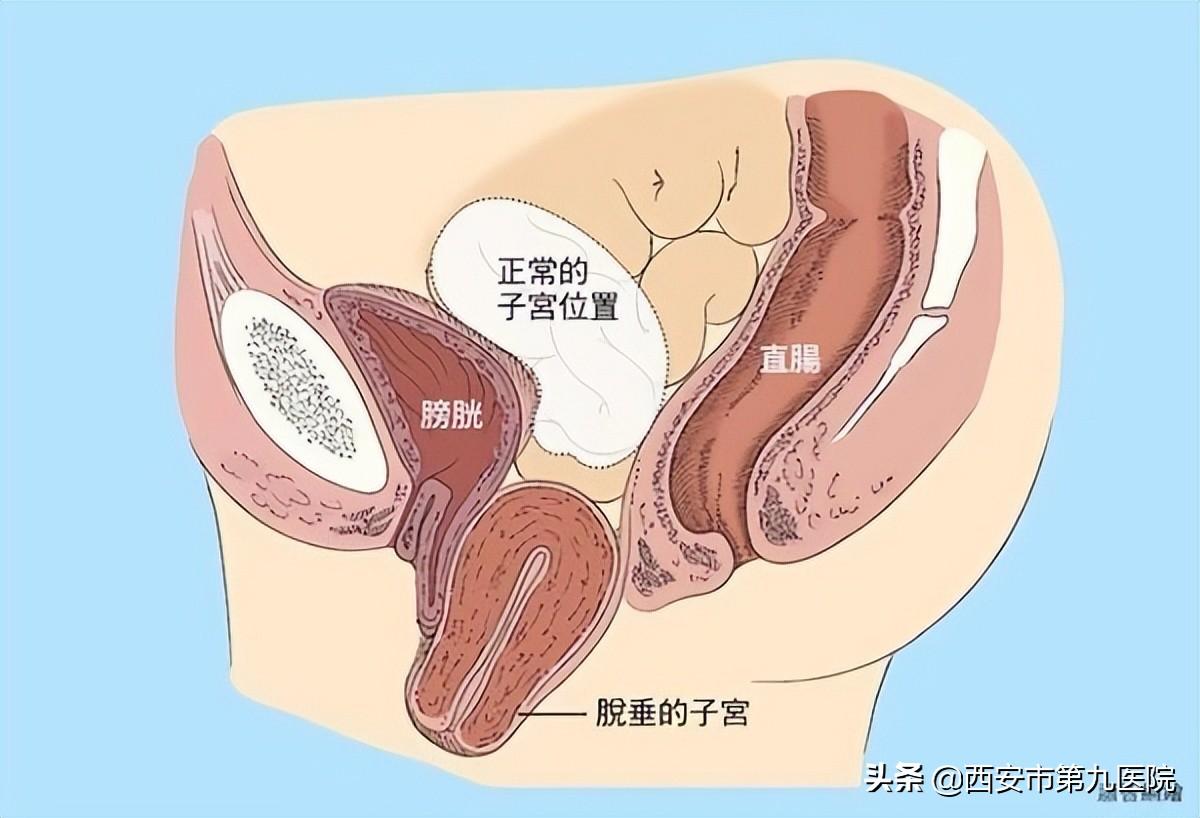 睪丸下垂松弛的原因及治療方法，睪丸下垂松弛的原因與治療方法解析