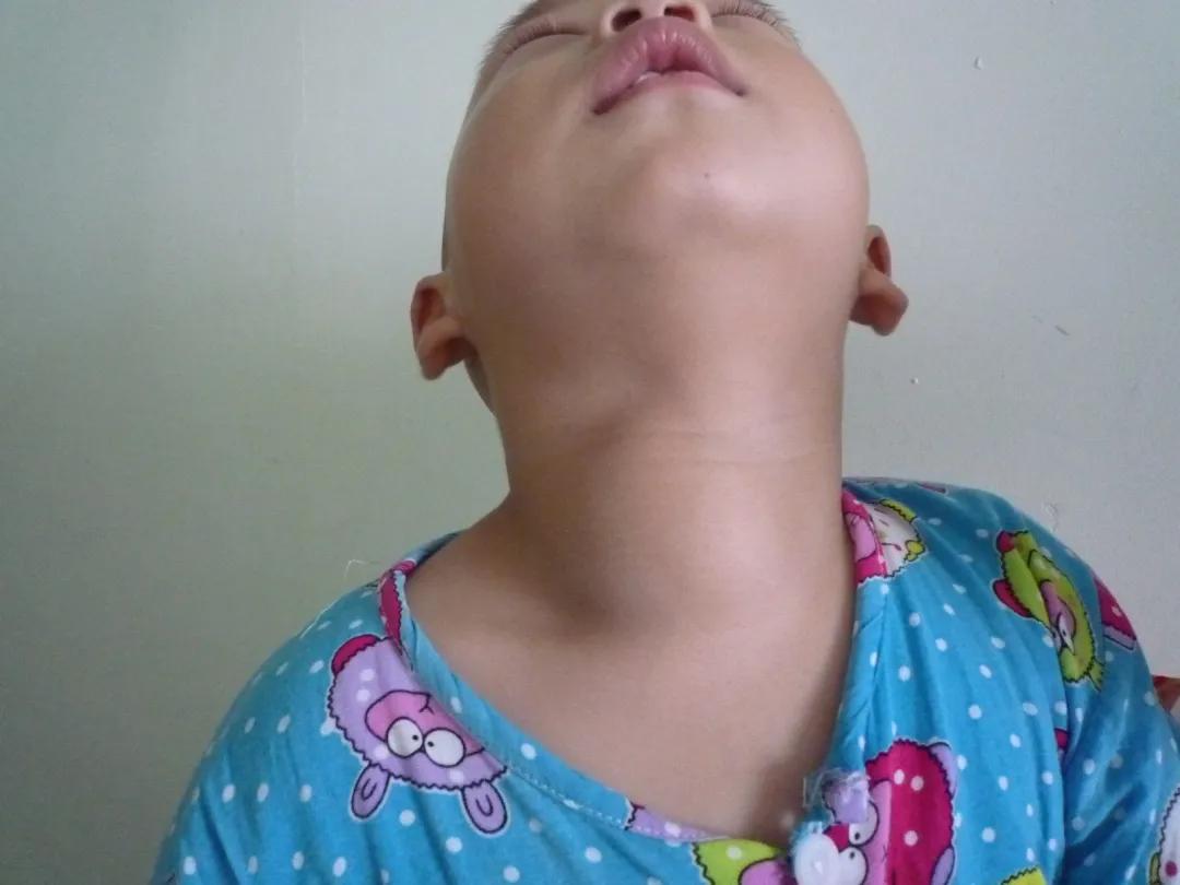 甲狀腺結(jié)節(jié)應(yīng)該掛什么科？一文詳解助您精準(zhǔn)就醫(yī)，甲狀腺結(jié)節(jié)詳解，該掛什么科？精準(zhǔn)就醫(yī)指南