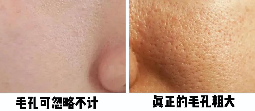 怎樣毛孔可以慢慢縮小，護(hù)膚秘籍與實(shí)用建議，護(hù)膚秘籍，縮小毛孔實(shí)用建議與指南