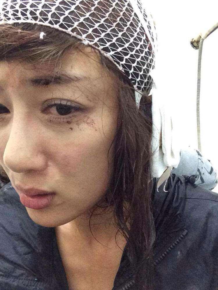 明星整容毀容最嚴(yán)重的是誰(shuí)，深度探討與反思，深度探討與反思，哪位明星整容遭遇最慘重的毀容？