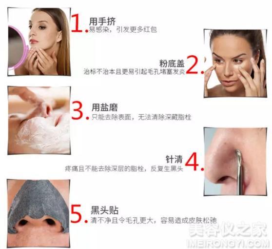 去黑頭的簡單小妙招，去黑頭小妙招分享，輕松告別黑頭困擾
