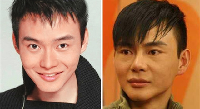 整過容的男明星名單，揭秘娛樂圈的顏值變革之旅，揭秘娛樂圈顏值變革之旅，整過容的男明星名單曝光