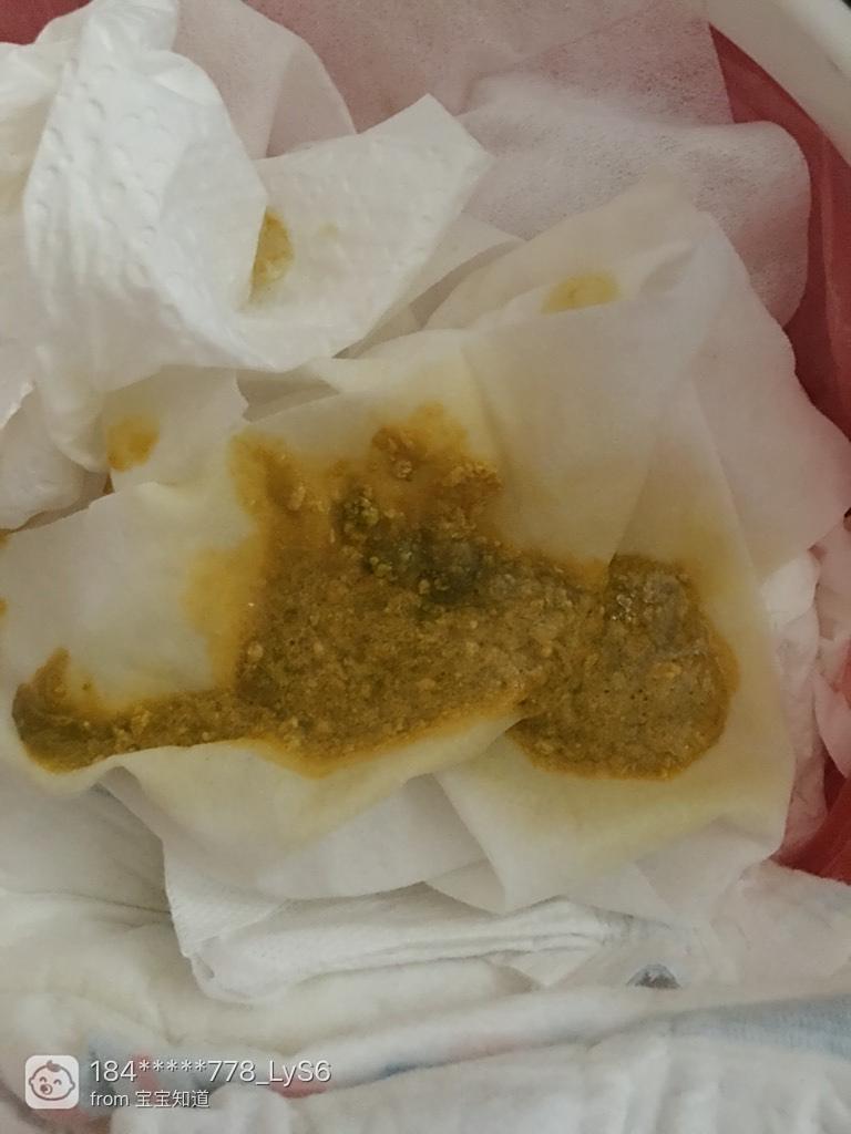 關(guān)于4個(gè)月的寶寶拉肚子怎么辦的全方位指南，4個(gè)月寶寶拉肚子應(yīng)對指南，全方位解決方案