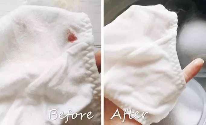 下面癢用什么清洗最好，全面解析與護(hù)理建議，女性私處護(hù)理指南，解決下體瘙癢問題，全面解析清洗方法與護(hù)理建議