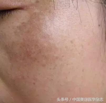 熱點(diǎn) 第143頁