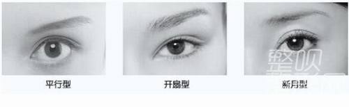 平扇與開扇雙眼皮，哪種更適合你？哪個(gè)更好看？，雙眼皮手術(shù)，平扇與開扇風(fēng)格的選擇與美觀度探討