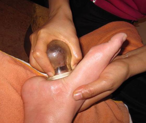 拔火罐對腎虛有好處嗎？深度解析傳統(tǒng)療法與現(xiàn)代健康理念，拔火罐對腎虛的益處解析，傳統(tǒng)療法與現(xiàn)代健康理念融合探索