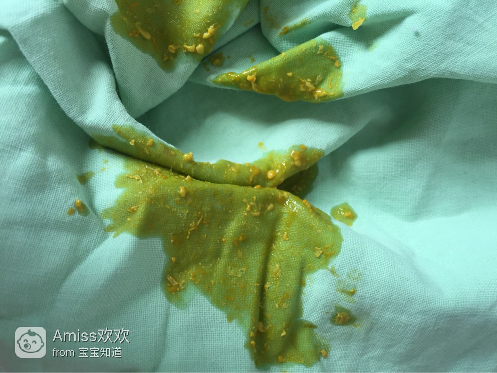 十來天的嬰兒老是拉稀怎么辦？全面解析寶寶腹瀉應(yīng)對之策，嬰兒腹瀉應(yīng)對指南，全面解析寶寶拉稀怎么辦？