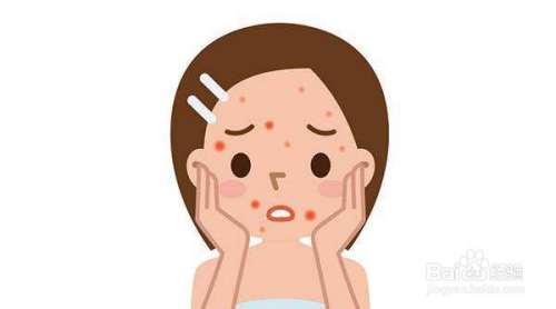 如何快速去除青春痘，方法與技巧詳解，快速去除青春痘方法與技巧詳解
