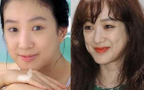 揭秘，韓國整容失敗的十大明星，揭秘，韓國整容失敗的明星TOP 10名單曝光