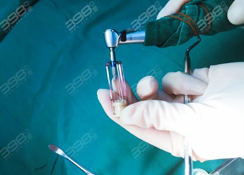 正規(guī)醫(yī)院拔智齒收費標(biāo)準(zhǔn)詳解，正規(guī)醫(yī)院拔智齒的收費標(biāo)準(zhǔn)詳解