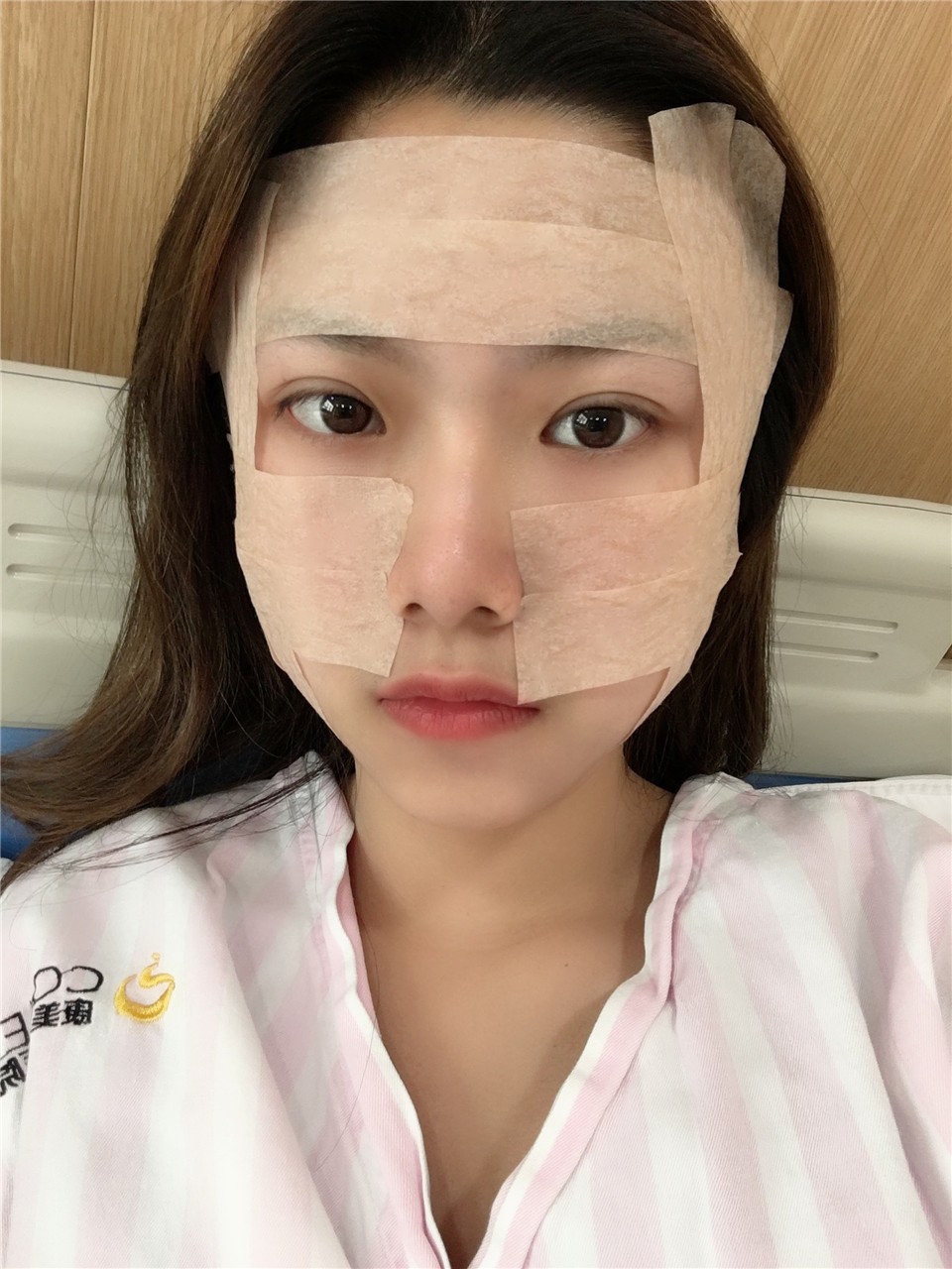 面部吸脂手術(shù)，重塑美麗輪廓的先進選擇，面部吸脂手術(shù)，重塑輪廓的先進之選