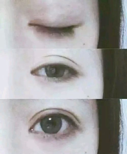 如何自然形成雙眼皮——天然方法解析，自然形成雙眼皮的秘訣，天然方法全解析