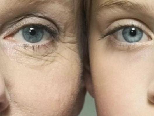 眼紋去除最佳方法，全面解析有效策略，眼紋去除秘訣大揭秘，全面解析最佳方法與有效策略