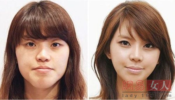 整容前后對照圖片大全，探索美麗轉(zhuǎn)變的藝術(shù)，整容前后對照圖片大全，美麗轉(zhuǎn)變的藝術(shù)探索