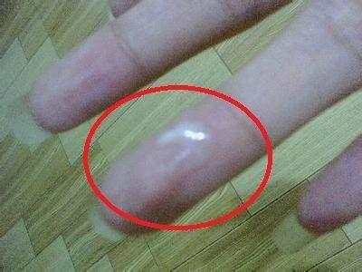 關(guān)于白帶異常，用手摳出豆腐渣狀白帶的解讀與處理建議，白帶異常解讀，豆腐渣狀白帶及處理建議