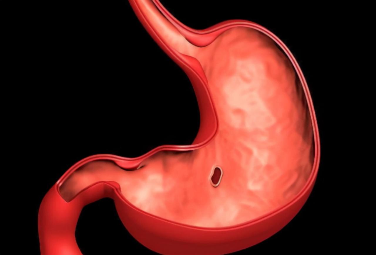 做胃鏡對胃傷害有多大，深入了解與關(guān)注，胃鏡對胃的影響，深入了解與關(guān)注