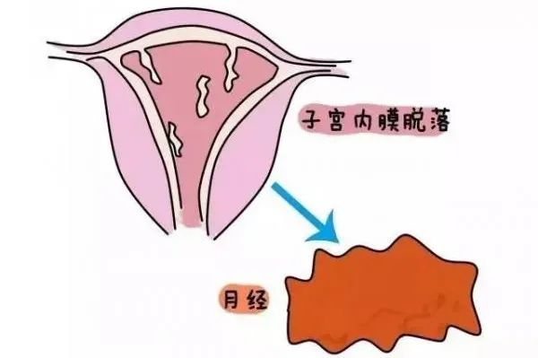 子宮內膜增厚能自愈嗎？解析與探討，子宮內膜增厚能否自愈？深度解析與探討