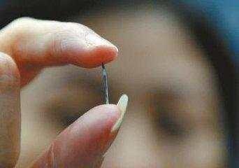 取環(huán)手術(shù)，一個(gè)人能否獨(dú)自面對(duì)？，獨(dú)自面對(duì)取環(huán)手術(shù)，挑戰(zhàn)與應(yīng)對(duì)之道