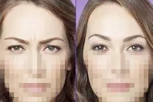 額頭千萬不能打除皺針，了解風險與后果，做出明智選擇，額頭除皺針的風險與后果，明智選擇需了解的內(nèi)容