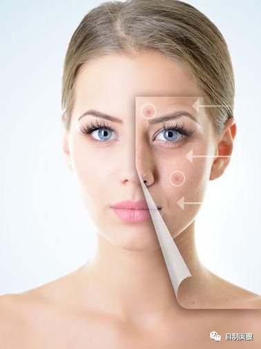 痘坑怎么去除最有效的方法，全面解析痘坑修復(fù)之道，全面解析，痘坑修復(fù)的最有效方法，痘坑去除指南