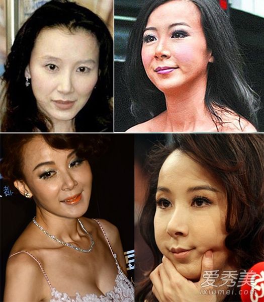 中國整容最自然的女明星，自然美與藝術(shù)的完美結(jié)合，中國整容最自然的女明星，自然美與藝術(shù)的和諧融合