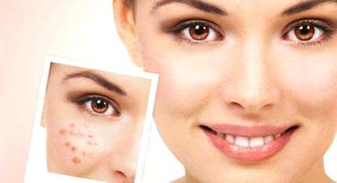 臉上長斑的原因及其影響因素，深度解析，深度解析，臉上長斑的原因及其影響因素