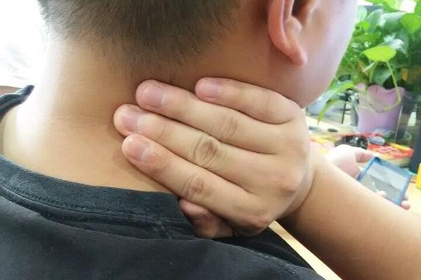 女性甲狀腺早期脖子圖片及其相關(guān)知識與識別，女性甲狀腺早期脖子癥狀圖片及識別與相關(guān)知識