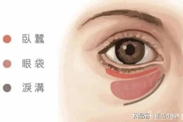 眼袋切除手術(shù)費(fèi)用詳解，價(jià)格因素與如何選擇合適的手術(shù)方案，眼袋切除手術(shù)費(fèi)用解析，了解價(jià)格因素與選擇最佳手術(shù)方案