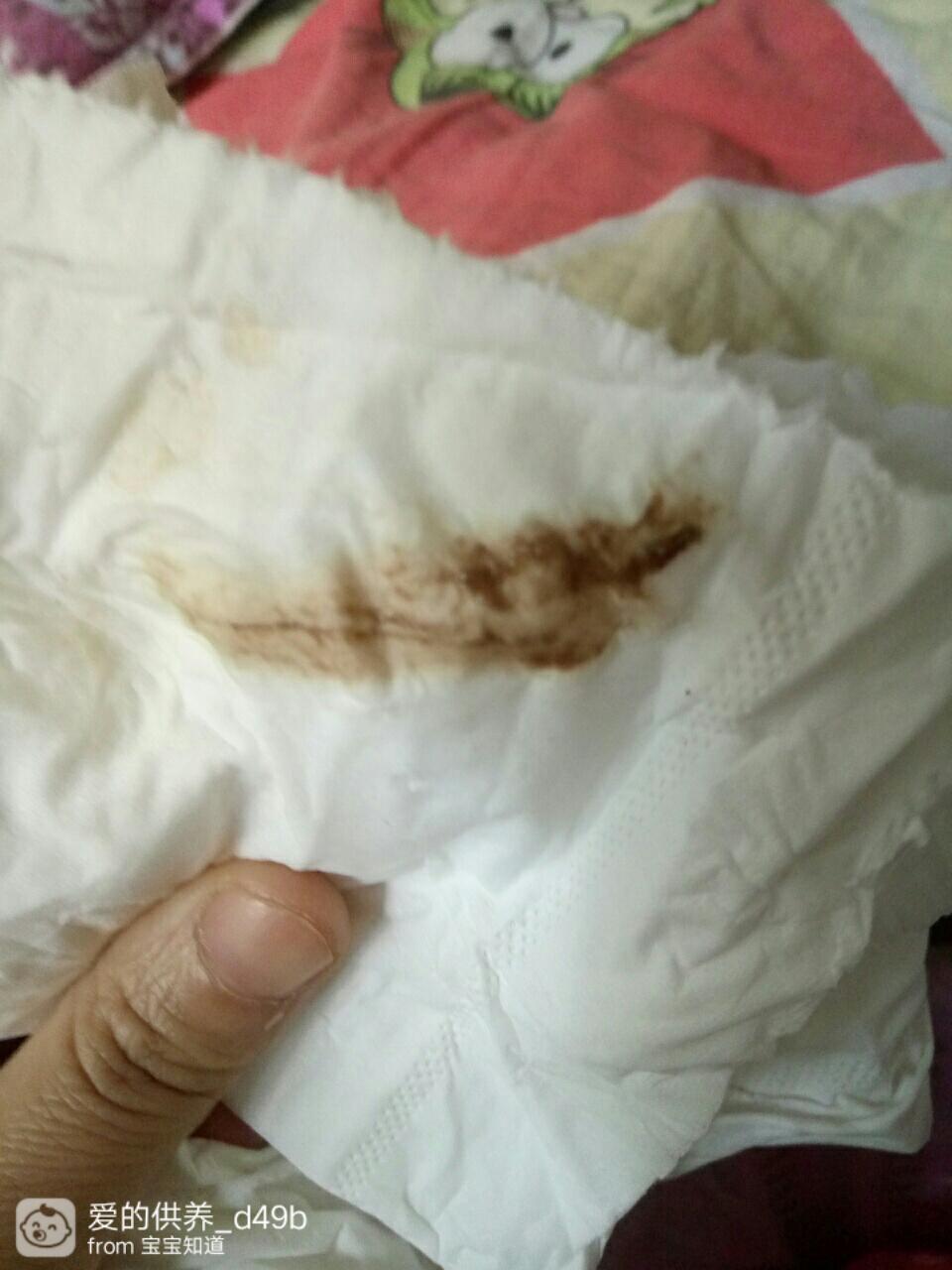 懷孕后流褐色血是好事嗎？——深入了解孕期出血真相，孕期流褐色血是好事嗎？揭秘孕期出血真相