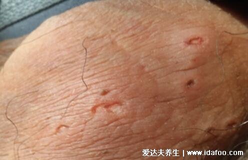 得性疾病前兆，了解、預(yù)防與應(yīng)對(duì)，得性疾病的早期信號(hào)，了解、預(yù)防與應(yīng)對(duì)策略