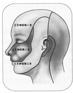 神經(jīng)痛的最佳治療方法，全面解析與個(gè)性化護(hù)理策略，神經(jīng)痛的最佳治療方法，全面解析與個(gè)性化護(hù)理方案