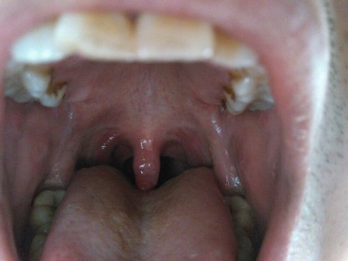 嗓子感覺糊了一層粘液，原因、緩解與預(yù)防策略，嗓子糊粘液，成因、緩解及預(yù)防策略