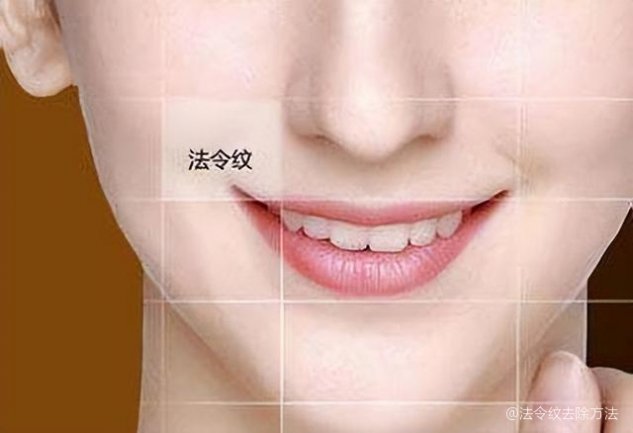 如何去除法令紋——打造青春無(wú)痕肌膚，如何消除法令紋，重塑青春無(wú)瑕肌膚