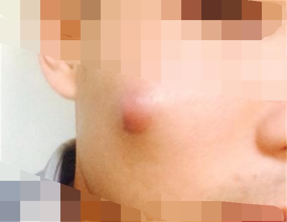 臉上一摸全是小顆粒，原因解析與應(yīng)對方法，臉部小顆粒密布，原因解析及應(yīng)對方法