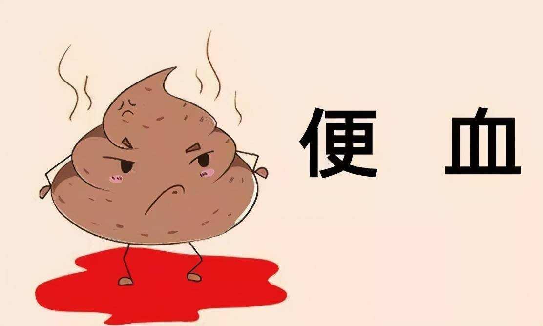 大便噴血滴鮮血無痛感，揭示潛在的健康問題，大便無痛性出血，揭示潛在健康問題的警示信號(hào)